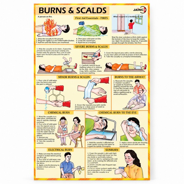 Burns and Scalds Chart